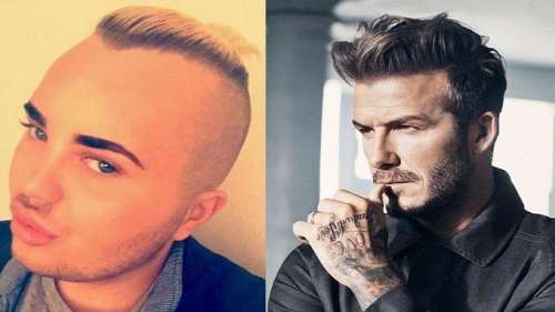 Il dépense 23 000€ pour ressembler à Beckham… et c’est plutôt raté ! 