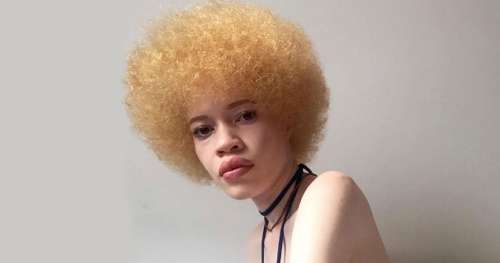Diandra Forrest, l’Afro-Américaine albinos qui casse les codes du mannequinat