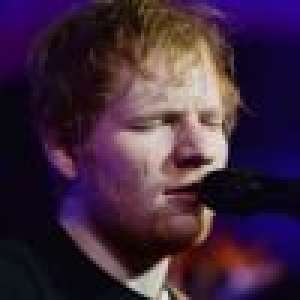 Ed Sheeran : D'où vient sa cicatrice sur le visage ?