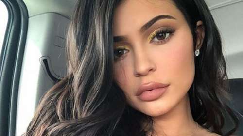Les lèvres de Kylie Jenner sont redevenues naturelles