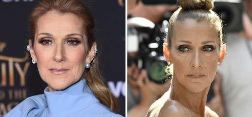 Des images dévastatrices montrent Céline Dion souffrant des symptômes d’une maladie invalidante des années avant le diagnostic