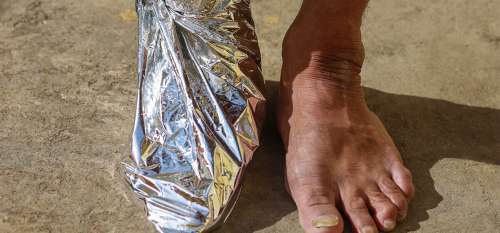 Si vous voyez les pieds d’une personne enveloppés dans du papier d’aluminium – voici ce que cela peut signifie