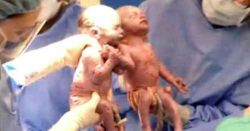 Personne ne comprend pourquoi médecin s’étonne quand elle met au monde des jumelles: alors maman est témoin d’une vision incroyable