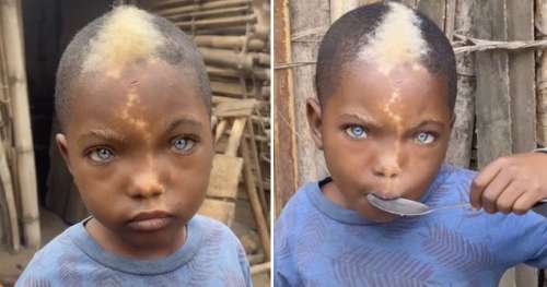 Un petit garçon aux yeux bleus naturels, aux cheveux blancs et à la marque d’éclair sur le visage devient viral