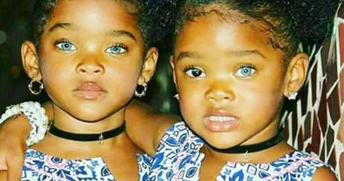 Découvrez les  » Trueblue Twins  » qui sont devenus des stars sur Instagram