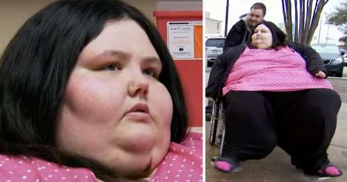 Cette femme pesait plus de 300 kg et était prisonnière chez elle – elle pèse désormais moins de 80 kg