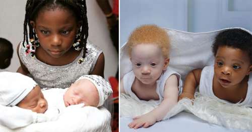 Une mère donne naissance à des jumeaux noirs et blancs – mais aucun des deux parents n’est blanc