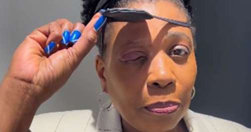 Le sombre point sur la santé de Brenda Edwards alors qu’elle est obligée de consulter un médecin pour des problèmes oculaires |  Nouvelles des célébrités |  Showbiz et télévision
