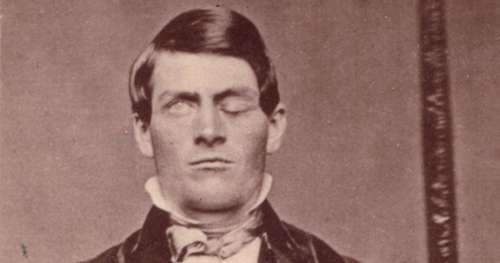 Comment l’effroyable accident de Phineas Gage a bouleversé la science du cerveau à jamais