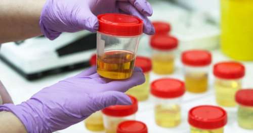 Alternative aux produits chimiques, l’urine pourrait devenir l’engrais de demain