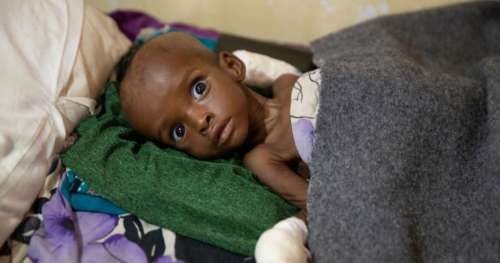 Un enfant sur trois souffre de malnutrition dans le monde