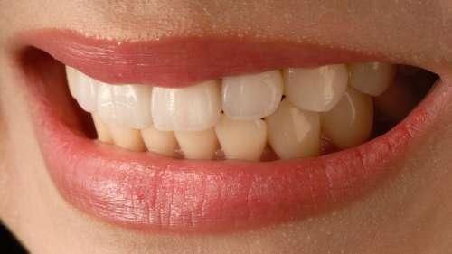 Le saviez-vous ? Les Romains utilisaient de l’urine pour blanchir leurs dents