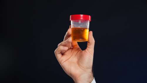 9 faits fascinants sur l’urine