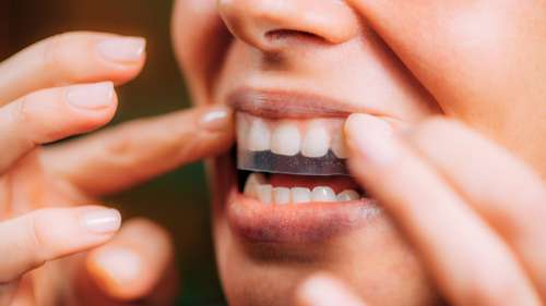 Voici comment vous pouvez blanchir naturellement vos dents à la maison