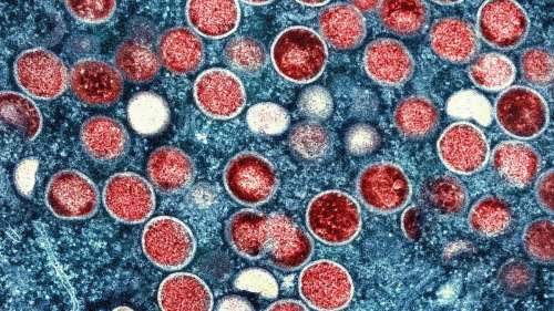 La variole du singe déclarée comme une urgence sanitaire mondiale par l’OMS