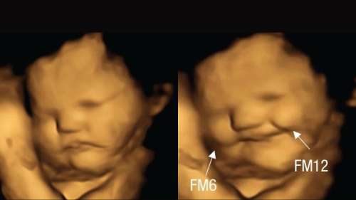 Les fœtus sourient ou grimacent en fonction des aliments ingérés par la mère