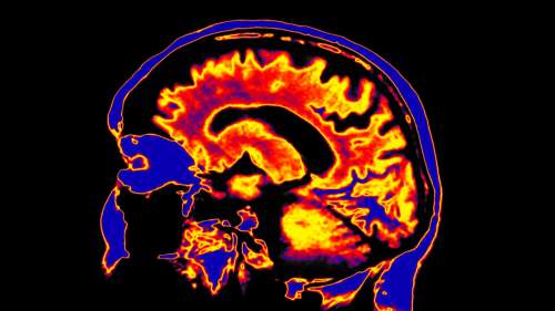 James Fallon, le neuroscientifique qui a découvert qu’il était un psychopathe