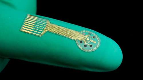 Ce pansement électronique pourrait un jour surveiller et soigner les plaies chroniques