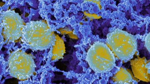 Les scientifiques découvrent comment cette superbactérie mortelle se cache à l’intérieur du corps