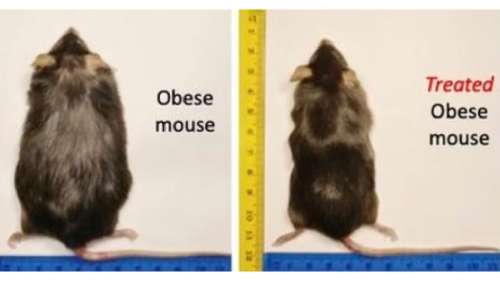 Ce nouveau médicament très efficace contre l’obésité ne présente aucun effet indésirable