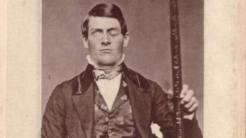 Comment le cerveau perforé de Phineas Gage a changé à jamais la médecine