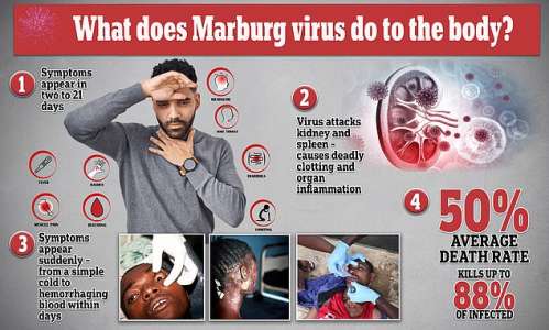 Virus de Marburg : Course contre la montre pour un vaccin contre la prochaine grande menace mondiale