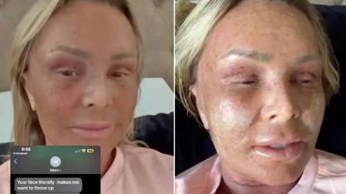 Tamra Judge révèle la réaction hilarante d’une mère au peeling chimique et au lifting des sourcils