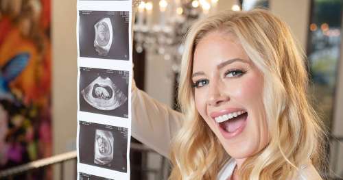 L’album Baby Bump de Heidi Montag, enceinte, avant le deuxième enfant : photos