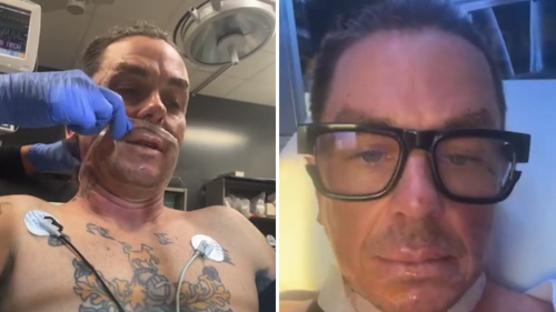 Sid Wilson de Slipknot hospitalisé pour de « graves brûlures » après une « explosion » dans une ferme | Actualités Ents & Arts