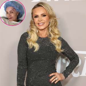 Tamra Judge, des Real Housewives of Orange County, fait l’objet d’un lifting des sourcils