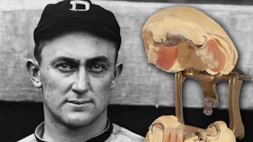 Les prothèses dentaires de Ty Cobb, légende de la MLB, mises aux enchères, fausses dents supérieures et inférieures