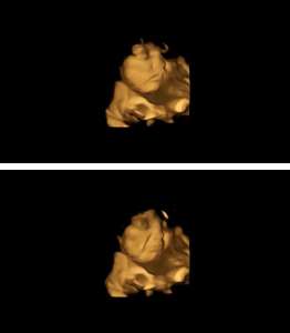 Ces scans fascinants montrent que les bébés réagissent dans l’utérus à ce que maman mange