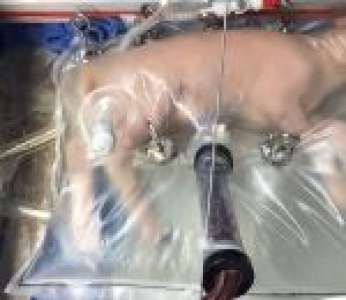 Biobag, un utérus artificiel permet à un agneau prématuré de poursuivre son développement