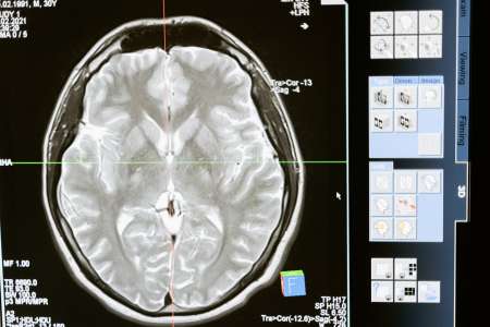 Voici les trois choses à faire pour son cerveau selon un neurochirurgien