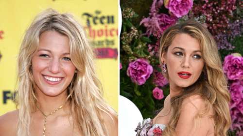 It Ends With Us (Jamais Plus) : Blake Lively se confie sur sa rhinoplastie, la 