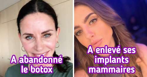 11 Stars qui ont décidé d’abandonner la chirurgie esthétique pour conserver leur beauté naturelle