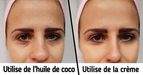 8 Procédures de beauté que tu ferais probablement mieux d’éviter