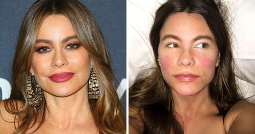 16 Célébrités qui n’ont pas peur de montrer leur look naturel