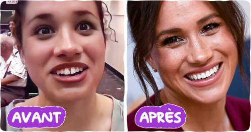 10+ Célébrités qui ont fait un bon travail sur leur sourire