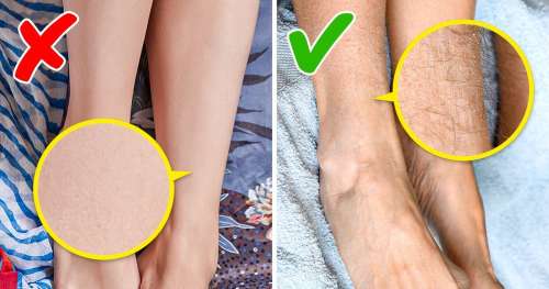 13 Conseils sur les soins des pieds que seul un pédicure-podologue expérimenté peut donner