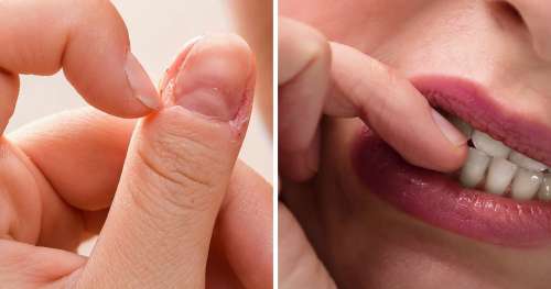 5 Choses que ton habitude de te ronger les ongles peut révéler de toi