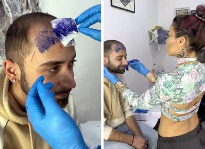 Un homme atteint de calvitie a décidé de se faire tatouer une frange