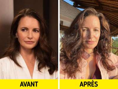 5 Célébrités qui ont retiré leurs produits de comblement du visage et qui ont adoré les résultats