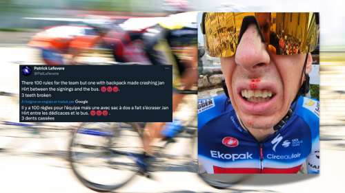 Trois dents de cassées avant même le départ du Tour de France
