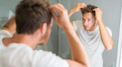 Calvitie : cette boisson consommée à outrance pourrait causer la chute de cheveux