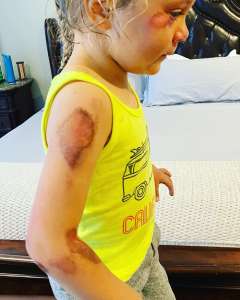 La fille d’Alfonso Ribeiro se fait opérer après un accident de scooter