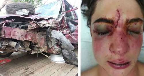 Un jeune de 17 ans décroche son téléphone en conduisant : des photos de l’accident illustrent les lourdes conséquences qu’a eues ce geste