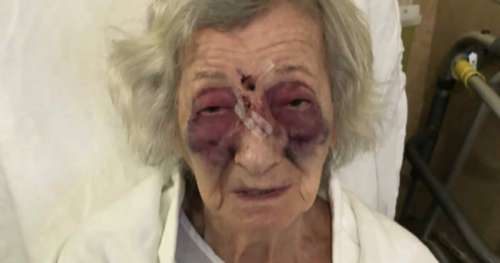 Une femme de 92 ans brutalement battue – alors qu’elle voyageait dans véhicule pour les personnes âgées et handicapées