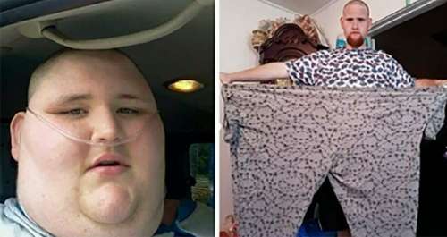 Une transformation étonnante: Le médecin donne 6 mois à vivre à l’homme, puis il perd 272 kg