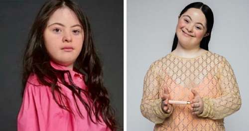 Une adolescente atteinte du syndrome de Down devenue la première mannequin à poser pour Gucci – bravo, Ellie